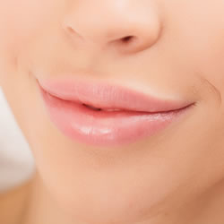 DERMAL FILLERS